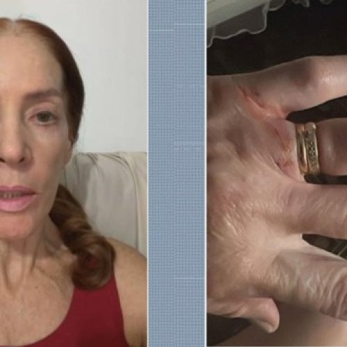 Médica agredida em assalto em São Paulo recebe alta e planeja mudar rotina de 15 anos: ‘Agora, tenho medo’